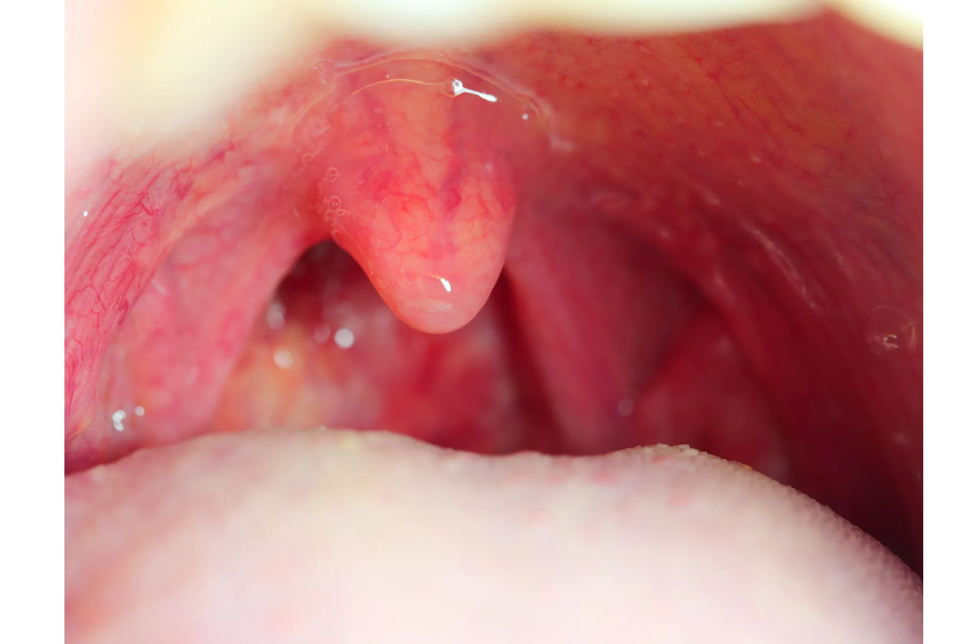 Risk Factors & Potential Causes