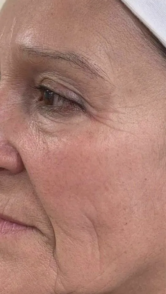 Facial and Hair Boosters