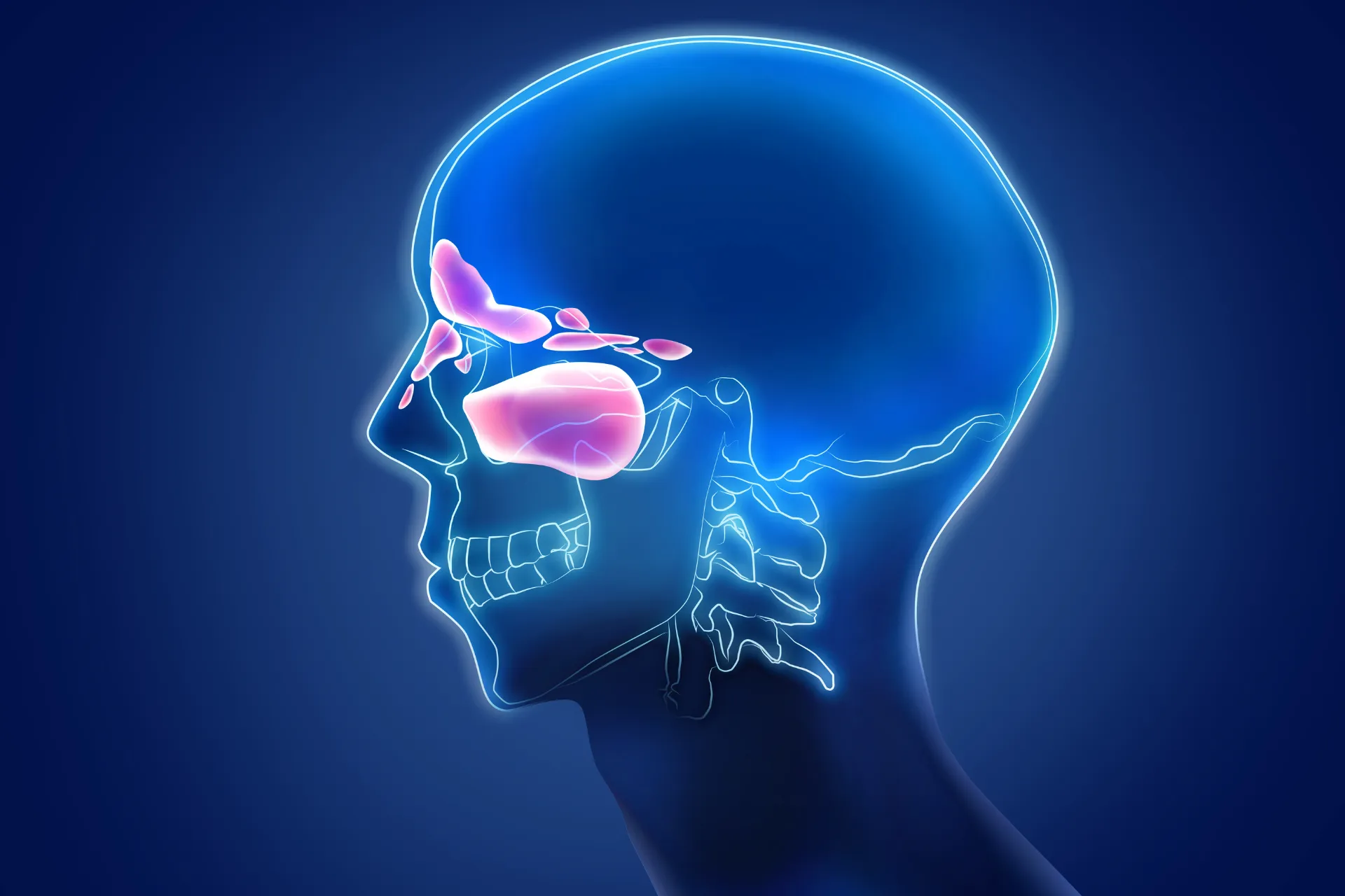 Pharmacy First - Sinusitis